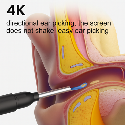 Smart Visual Ear Wax Cleaner